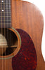 Martin D15 Used front detail - soundhole wear