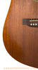 Martin D15 Used front lower bout